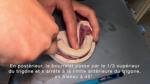 Bases d'occlusion.mp4